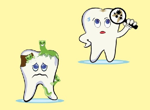 bệnh sâu răng 4