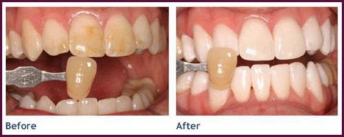 cách chữa bệnh tâm thần hoang tưởng