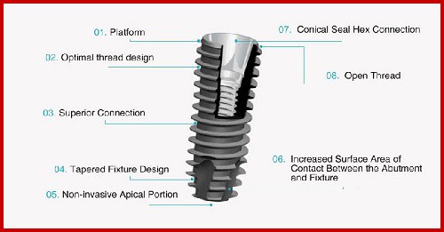 cấy ghép implant hàn quốc có tốt không 3