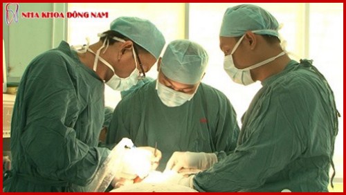 cấy ghép implant hàn quốc có tốt không 5