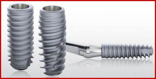 chi phí trồng răng implant pháp giá bao nhiêu 1