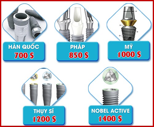 chi phí trồng răng implant pháp giá bao nhiêu 4