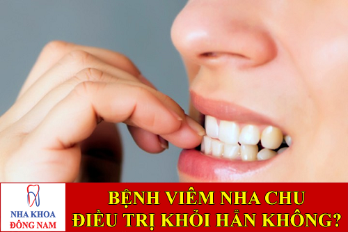 bệnh viêm nha chu có điều trị khỏi hẳn được không -1