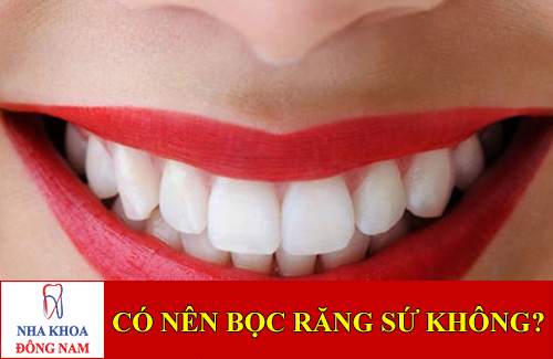 có nên bọc răng sứ không