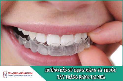 hướng dẫn cách dùng máng và thuốc tẩy trắng răng tại nhà