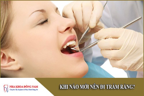 khi nào mới nên đi trám răng