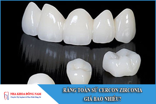 răng toàn sứ cercon zirconia giá bao nhiêu