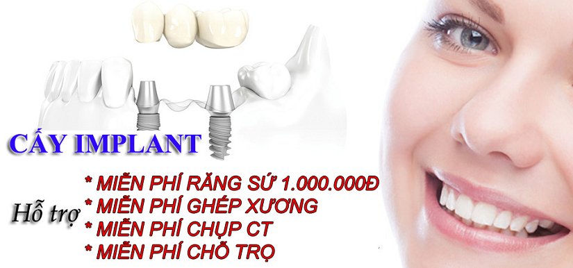 trồng răng giả nguyên hàm bằng cấy ghép implant -7