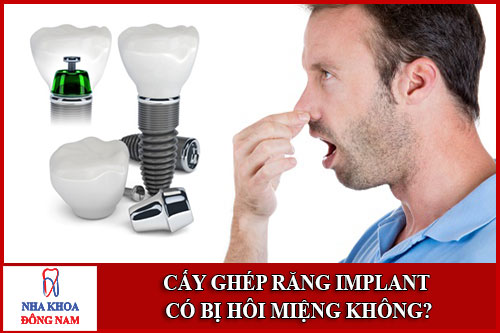 Cấy ghép Răng Implant có bị hôi miệng không
