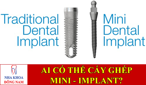 ai có thể cấy ghép răng bằng mini implant -1