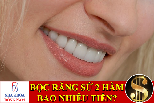 bọc răng sứ thẩm mỹ 2 hàm bao nhiêu tiền -1
