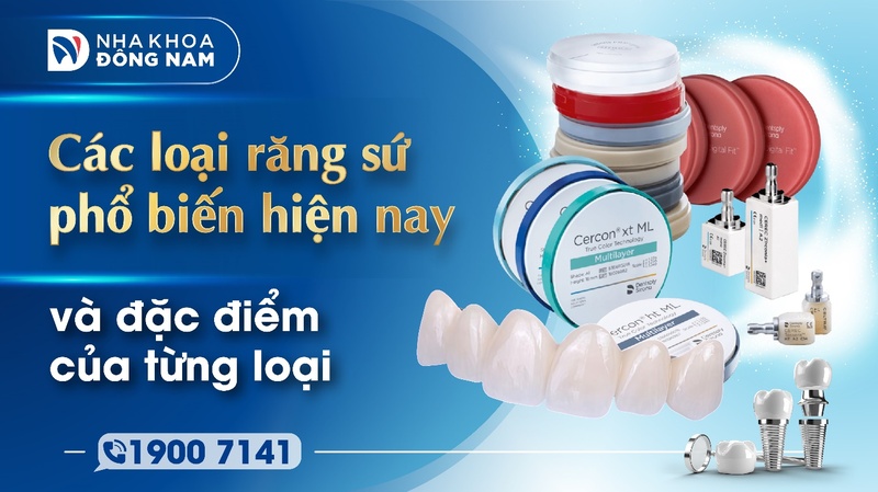 Các loại răng sứ phổ biến hiện nay
