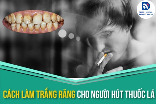 Cách làm trắng răng cho người hút thuốc lá