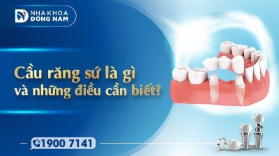 Cầu răng sứ là gì và những điều cần biết