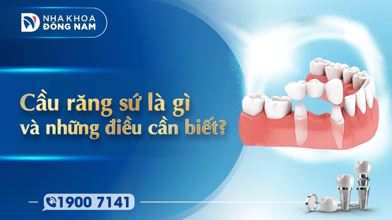 Cầu răng sứ là gì và những điều cần biết