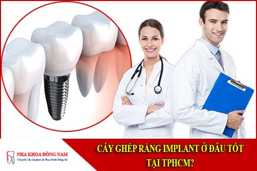 cấy ghép răng implant ở đâu tốt tại tphcm