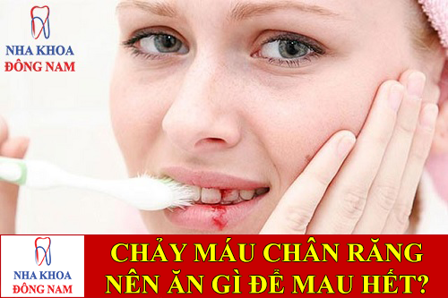 chảy máu chân răng nên ăn gì -1
