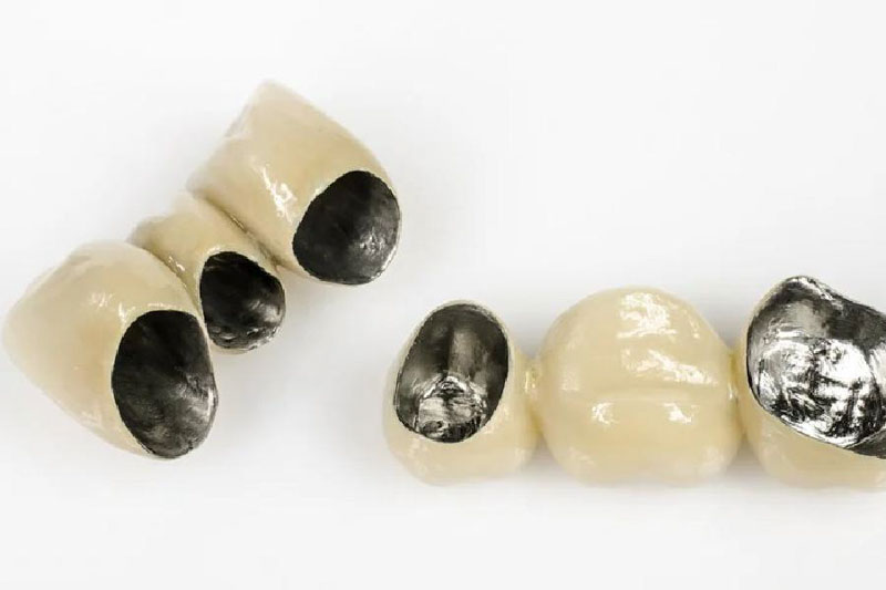 Đặc điểm răng sứ Crom-Cobalt