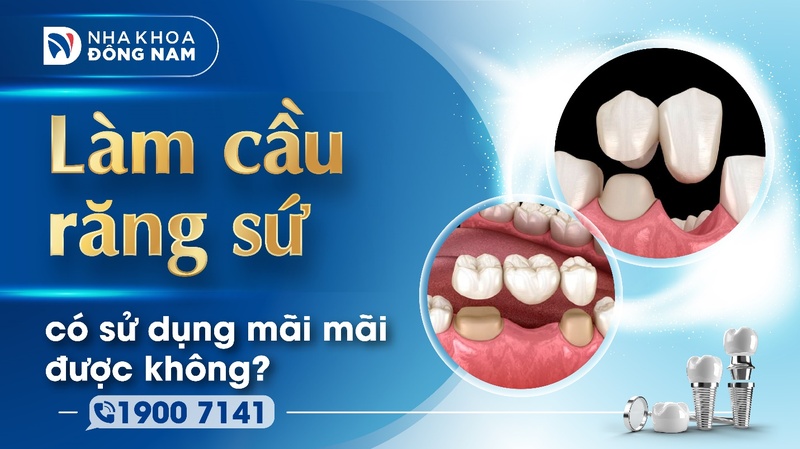 Làm cầu răng sứ có sử dụng mãi mãi được không