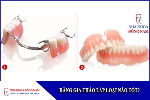 răng giả tháo lắp loại nào tốt