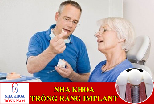 nha khoa trồng răng implant tốt nhất tphcm -1