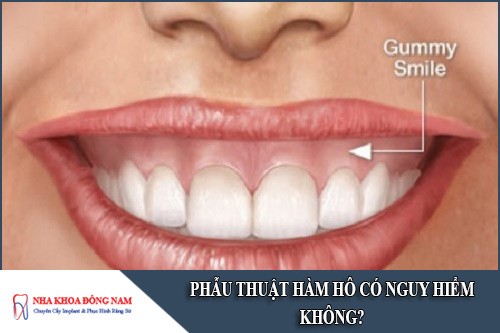 phẫu thuật hàm hô có nguy hiểm không