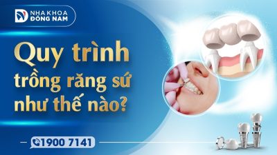 Quy trình trồng răng sứ như thế nào