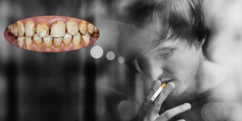 Răng bị ố vàng do hút thuốc lá