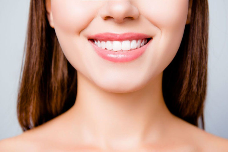 Răng toàn sứ mang lại giá trị thẩm mỹ cao
