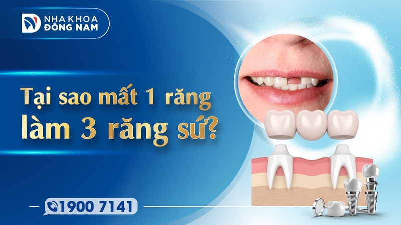 Tại sao mất 1 răng làm 3 răng sứ