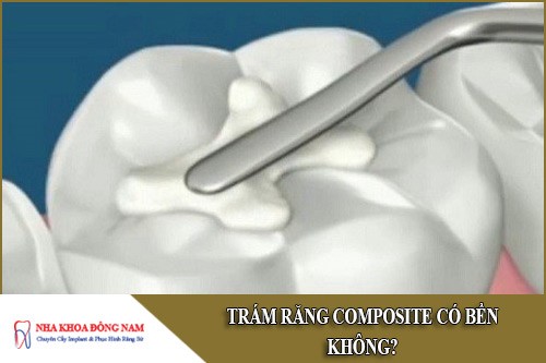 trám răng composite có bền không