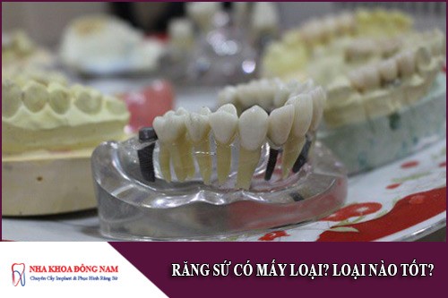 răng sứ có mấy loại?