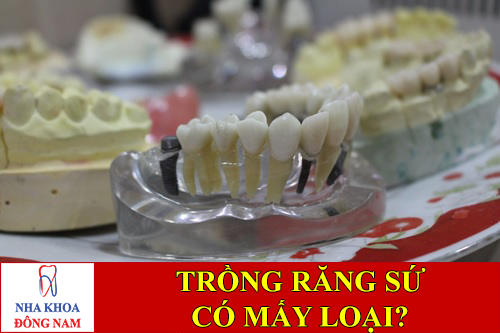trồng răng sứ có mấy loại -1