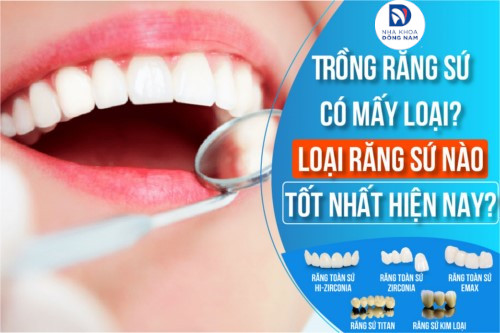 Trồng răng sứ có mấy loại? Loại nào tốt?