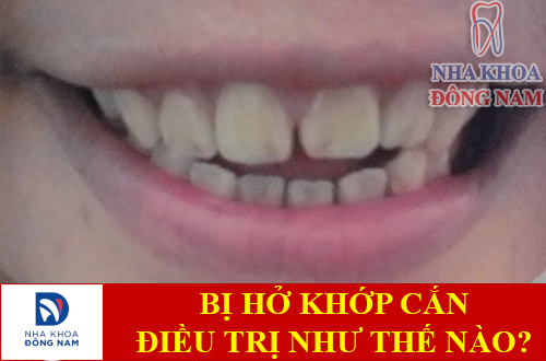bi-ho-khop-can-phai-dieu-tri-the-nao-1