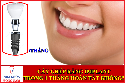 cấy ghép răng implant trong 1 tháng có hoàn tất không -2