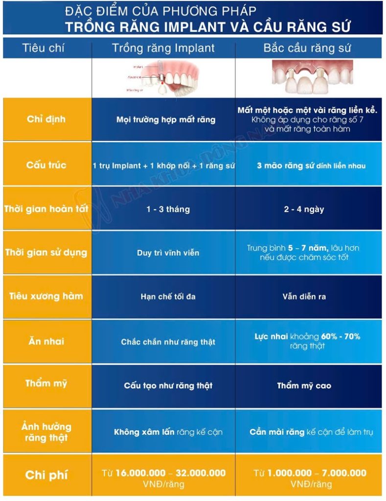 So sánh cầu răng sứ và Implant