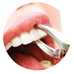 dịch vụ nha khoa nhổ răng