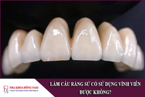 làm cầu răng sứ có sử dụng vĩnh viễn được không