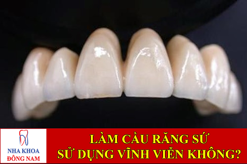làm cầu răng sứ có sử dụng vĩnh viễn được không -1