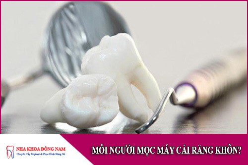 mỗi người mọc mấy cái răng khôn