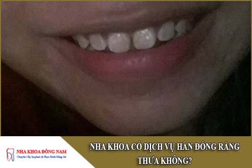 nha khoa có dịch vụ hàn đóng răng thưa không