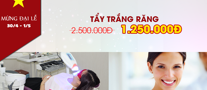 nha khoa giảm giá 50% tẩy trắng răng nhân dịp 30 tháng 4 -1