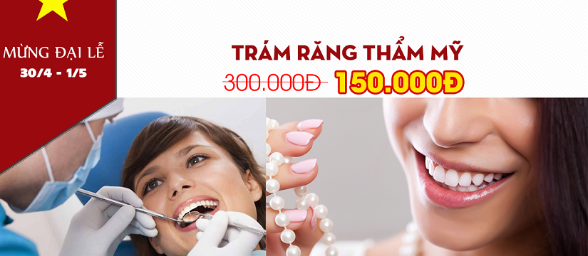 nha khoa giảm giá 50% trám răng thẩm mỹ nhân dịp 30 tháng 4 -1