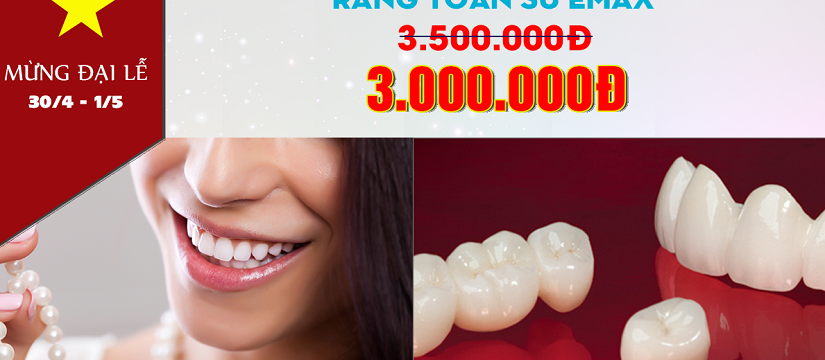 nha khoa giảm giá răng sứ emax nhân dịp 30 tháng 4 -1