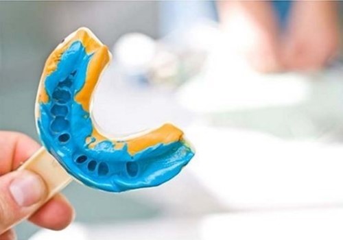 quy trình làm hàm giả tháo lắp