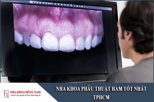 nha khoa phẫu thuật hàm tốt nhất tphcm