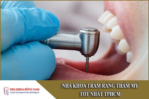 nha khoa trám răng thẩm mỹ tốt nhất tphcm