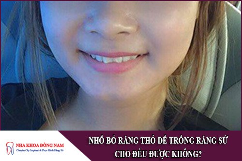 nhổ bỏ răng thỏ để trồng răng sứ cho đều được không
