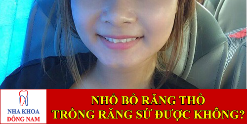 nhổ bỏ răng thỏ trồng răng sứ cho đều được không -1